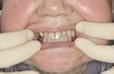 20年ほど前、私が義歯を作った患者さん