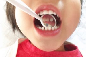 自分の口のなかってキレイ？～磨き残しを確認しよう～