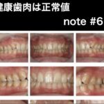 健康歯肉は正常値　note記事  #6